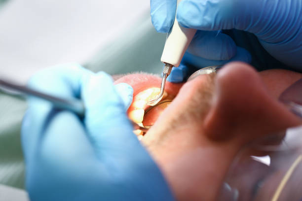 Best Chipped Tooth Repair Near Me  in Jeffersonville, IN